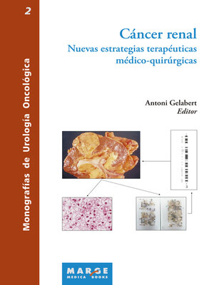 cover image of Cáncer renal